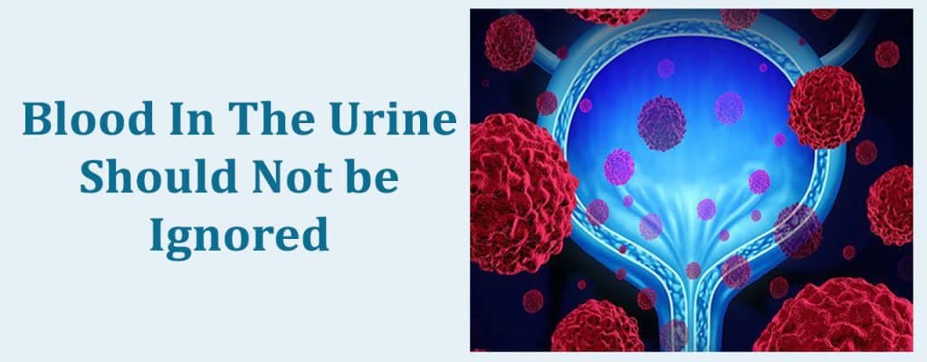 Blood In The Urine Should Not Be Ignored