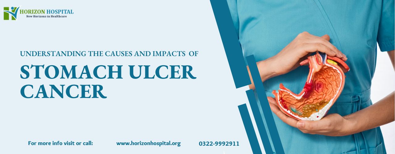 Understanding the Causes and Impacts of Stomach Ulcer Cancer