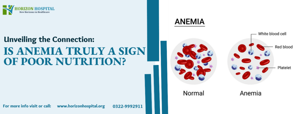 Unveiling the Connection: Is Anemia Truly a Sign of Poor Nutrition?