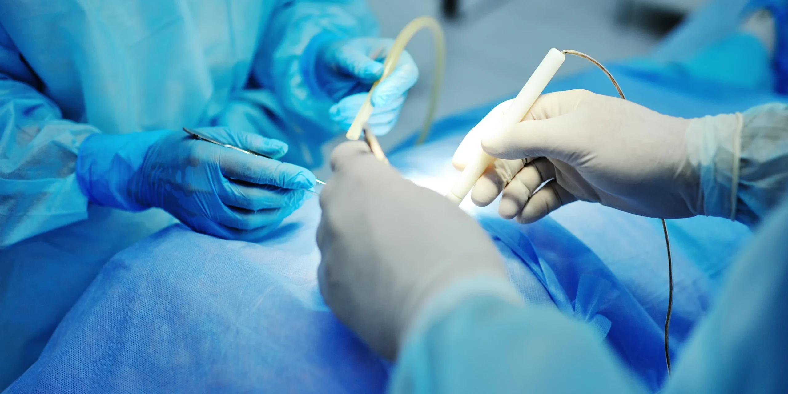 laproscopic-surgery laproscopic-surgery