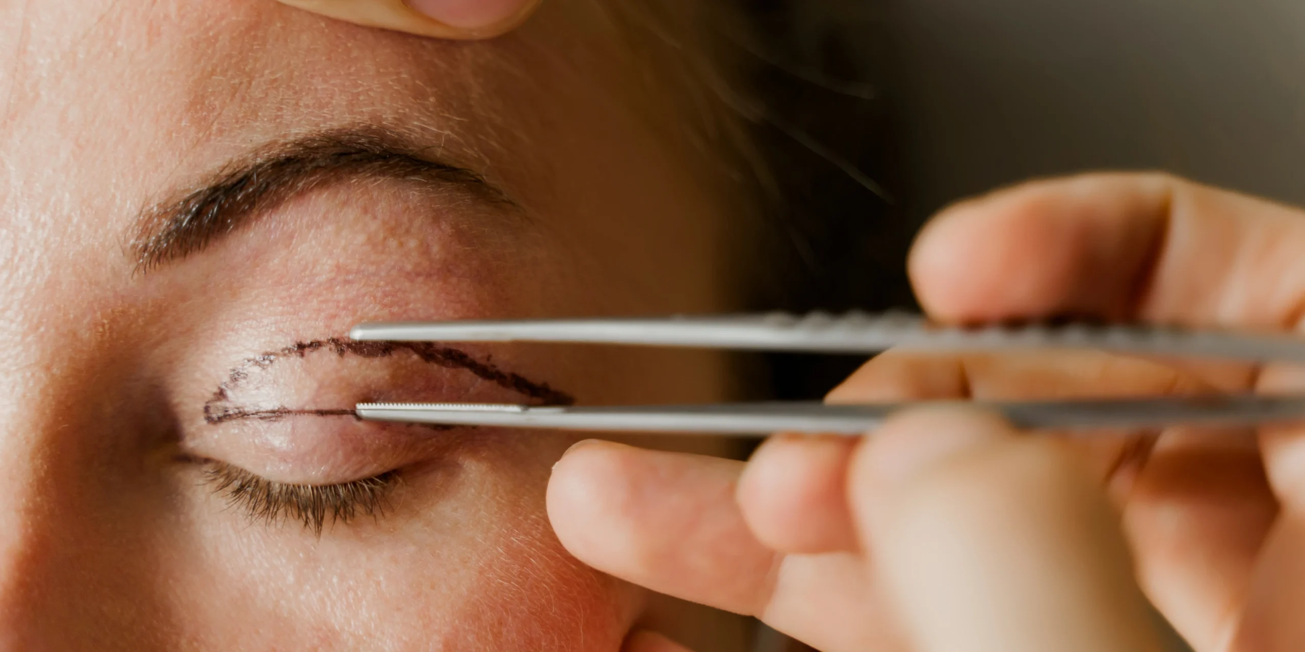 costmetic and plastic surgery